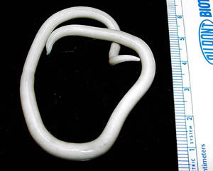 <p><strong>Fig. 3.41.</strong>&nbsp;(<strong>C</strong>) Giant roundworm (<em>Ascaris lumbricoides</em>), the nematode parasite that causes the disease ascariasis in humans</p>
