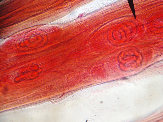 <p><strong>Fig. 3.41.</strong> (<strong>D</strong>) Pork worm <em>Trichinella spiralis</em> inside pig muscle tissue (under black pointer), the nematode parasite that causes the disease trichinosis in humans</p>