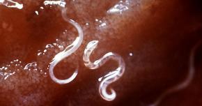 <p><strong>Fig. 3.41.</strong> (<strong>A</strong>) Parasitic hookworms (<em>Ancylostoma caninum</em>) in human intestinal tract</p>
