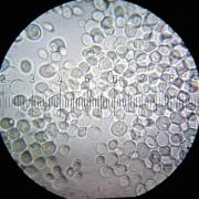 <p><strong>SF Fig. 1.1.</strong> (<strong>B</strong>) <em>Saccharomyces cerevisiae</em> baker’s yeast. Numbered marks are 11 micrometers apart.</p>