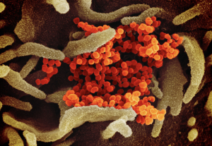 Courtesy NIH: Microscope image of SARS-CoV-2, the virus that causes COVID-19.