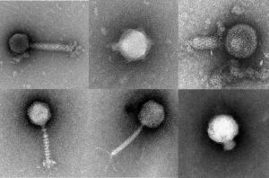 Transmission electron micrographs of viruses. Credit: University of Delaware.