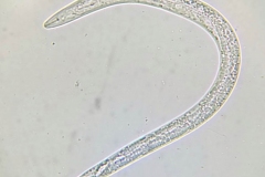 plant-parasitic-nematode-with-stylet_27834122886_o