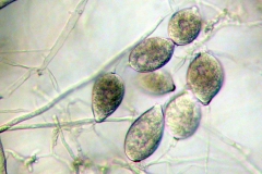 phytophthora-colocasiae-zoosporangia_28829032547_o