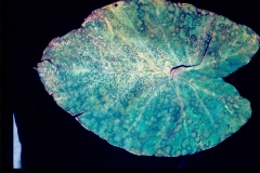 taro-cladosporium-leaf-spot_12226125923_o