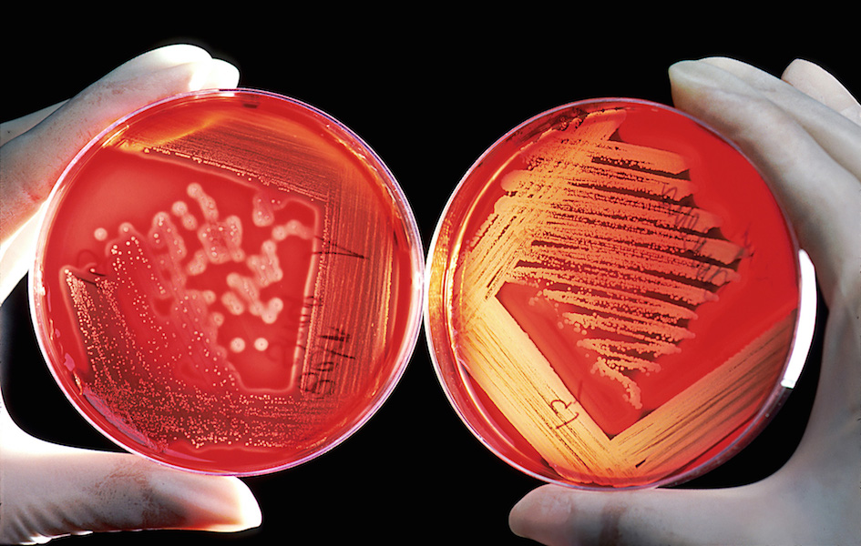 <p><strong>Fig. 2.32.</strong> (<strong>A</strong>) Agar gel plates made from red algae are used to grow bacteria and diagnose infectious diseases in humans.</p>