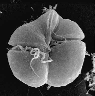 <p><strong>Fig. 2.37.</strong> &nbsp;(<strong>B</strong>) <em>Karenia </em><em>brevis</em> is one of several dinoflagellate species thought to cause red tides that are harmful to humans.</p>