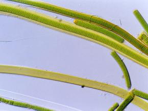 <p><strong>Fig. 2.25.</strong> (<strong>A</strong>) <em>Lyngbya</em> sp. a filamentous cyanobacterium (blue-green algae) under a microscope.</p>
