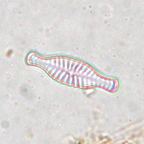 <p><strong>Fig. 2.34.</strong>&nbsp;(<strong>C</strong>) Diatom <em>Navicula stesvicensis</em></p>

