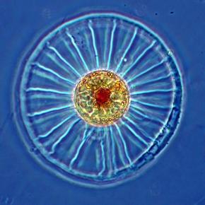 <p><strong>Fig. 2.34.</strong>&nbsp;(<strong>D</strong>) Wagon-wheel diatom</p>
