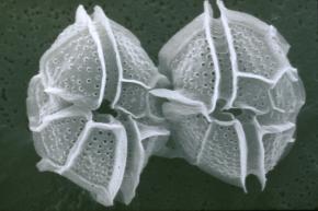 <p><strong>Fig. 2.35.</strong> (<strong>A</strong>) Scanning electron microscope image of dinoflagellates</p>
