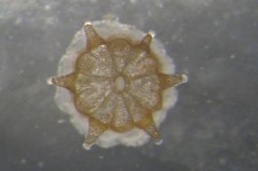 <p><strong>Fig. 2.35.</strong>&nbsp;(<strong>C</strong>) A coral polyp has a symbiotic relationship with photosynthetic dinoflagellates living within its tissue. The brown specks in the coral polyp are individual dinoflagellate cells.</p>

