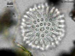 <p><strong>Fig. 3.5.</strong> (<strong>B</strong>) Microscope image of a small colony of choanoflagellate cells (approximately 230 individuals; black bar indicates 10 micrometers or 0.01 millimeters)</p>
