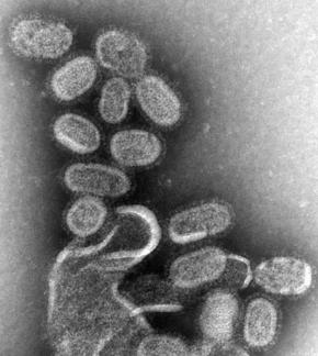 <p><strong>SF Fig. 1.4.</strong> (<strong>A</strong>) A transmission electron microscope image shows the <em>Influenza</em> A H1N1 virus.</p>
