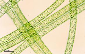 <p><strong>SF Fig. 2.2.</strong> (<strong>C</strong>) Filaments of the freshwater green alga <em>Spirogyra</em> sp. viewed under a light microscope with 300x magnification</p>
