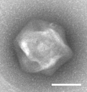 Transmission electron micrograph of negatively stained FloV-SA2 virus particles. Scale bar: 100 nm