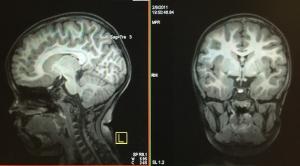 JABSOM brain scan included in Nature Neuroscience journal article.