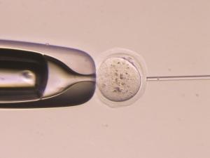 ICSI, developed at the IBR, is used around the world for in vitro fertilization.
