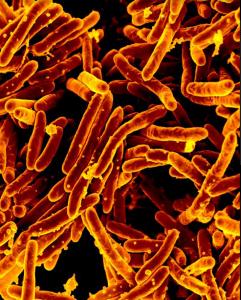 Mycobacterium tuberculosis bacteria, which cause tuberculosis.